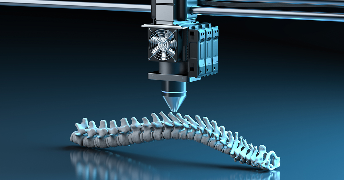 3D Printing A Revolutionary Force in Healthcare