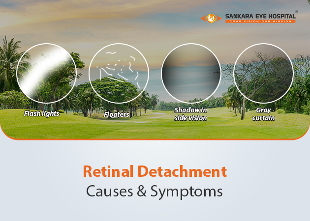 Retinal Detachment