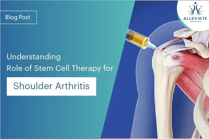 Stem Cell Therapy for Arthritis