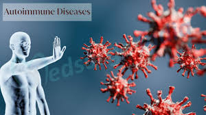 Autoimmune Diseases