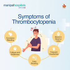 Thrombocytopenia