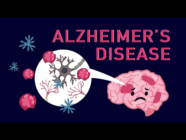 Alzheimer's Disease